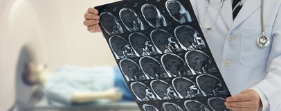 Безоплатні медичні послуги у випадку інсульту під час війни